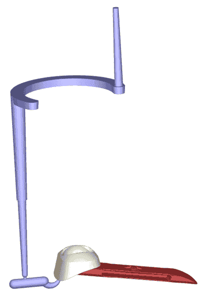Moldex3D模流分析之 格设定及提供更客制化的BLM选项