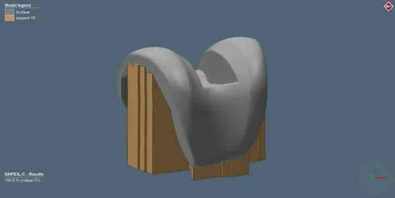 Simufact Additive——3D打印仿真软件在医疗行业的应用